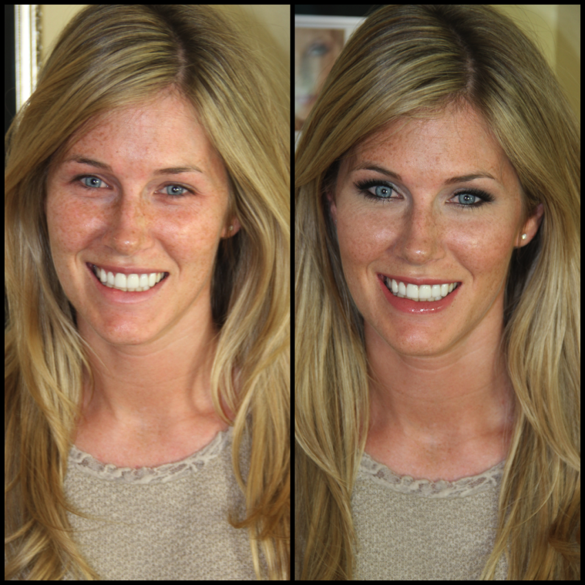 Makeup Before and After: A Perfect Example of Why Not to Cover Up Freckles